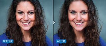 Skin Retouching - Photo Editing techniques